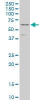 DPYSL3 / CRMP4 Antibody (clone 1B8)