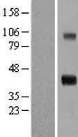 CCN4 / WISP1 Protein (Over-Expression Lysate Myc-DDK (Flag))