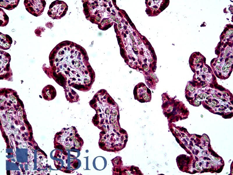 IHC-plus™ Polyclonal Goat anti-Human SH3KBP1 / CIN85 Antibody (aa2-14, IHC)