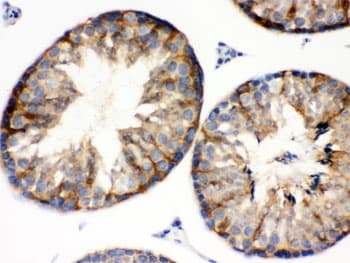 Polyclonal Rabbit anti-Human BAG2 Antibody (IHC, WB)