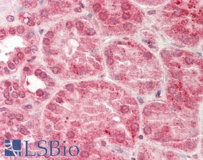 SERPINA5 / PCI Antibody (aa326-375)
