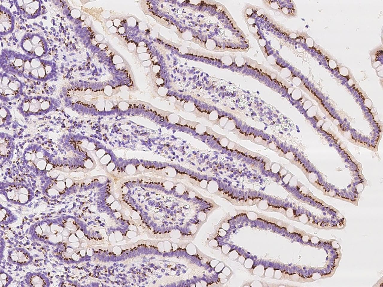 TM9SF3 Antibody