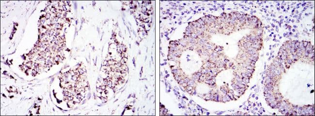Monoclonal Mouse anti-Human HSPD1 / HSP60 Antibody (clone 3G8, IHC, IF, WB)