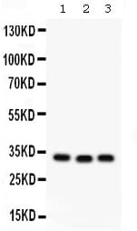 GC1qR / C1QBP Antibody