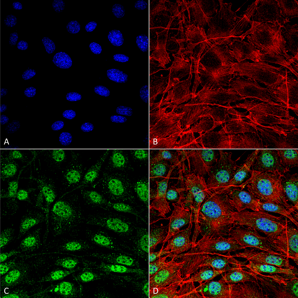 SQSTM1 Antibody (Biotin)
