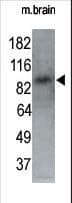 MARK1 / MARK Antibody (aa6-40)