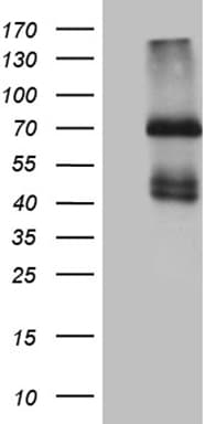 IL2RB / CD122 Antibody (aa27-240+Mouse, clone OTI1B5)