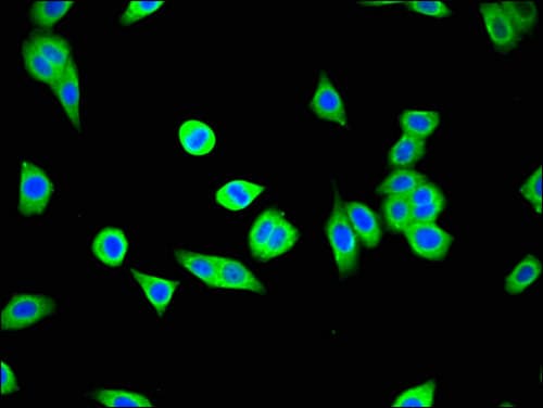 USP25 Antibody