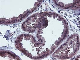 FGFR2 / FGF Receptor 2 Antibody (clone OTI5C5)