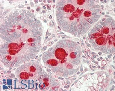 IHC-plus™ Polyclonal Rabbit anti-Human MLZE Antibody (aa109-158, IHC, WB)