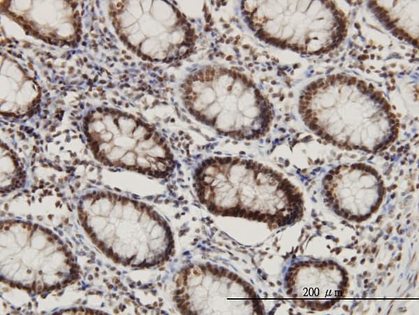Monoclonal Mouse anti-Human CHD3 Antibody (clone 5E12, IHC, WB)