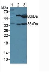 LRG1 / LRG Antibody (aa136-342)