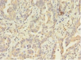ATXN3 / JOS Antibody (aa1-288)