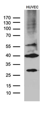 Monoclonal Mouse anti-Human GNA14 Antibody (clone OTI3E8, aa31-348, IHC, WB)