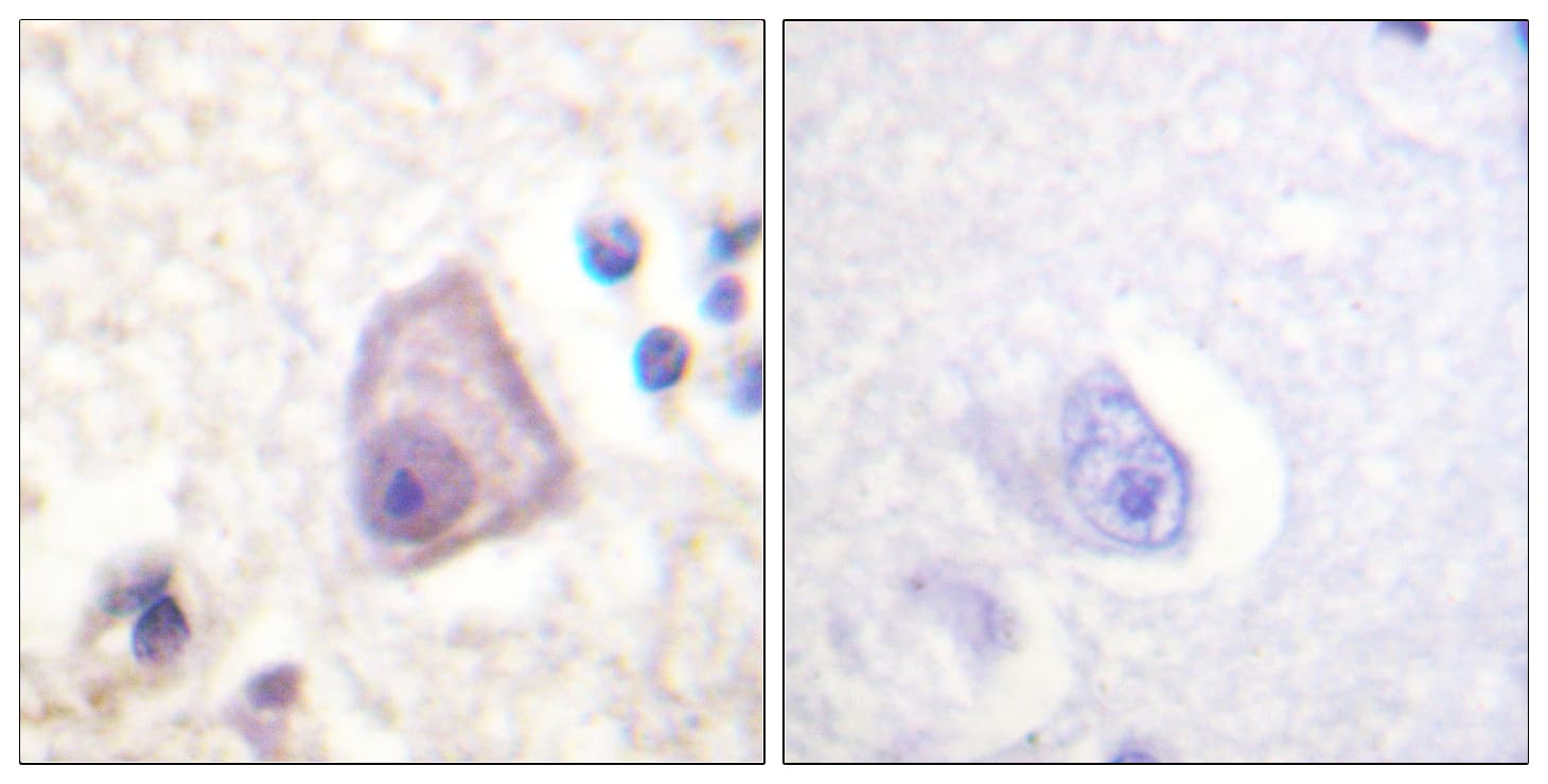 Polyclonal Rabbit anti-Human MAP2K4 / MKK4 Antibody (phospho-Ser257, IHC)