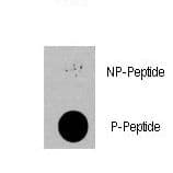 Polyclonal Rabbit anti-Human PDPK1 / PDK1 Antibody (phospho-Ser396)