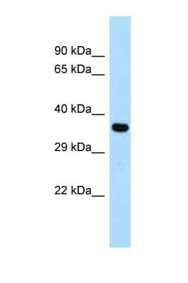 CYSLTR1 / CYSLT1 Antibody (aa199-248)