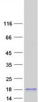 Human SPACA4 / SAMP14 Protein (Recombinant Myc-DDK (Flag))
