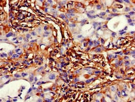 Polyclonal Rabbit anti-Human TMEM49 Antibody (IHC, WB)
