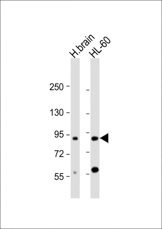 Polyclonal Rabbit anti-Human CCDC144A Antibody (C-Terminus, WB)