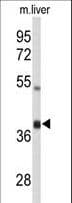 AMID / AIFM2 Antibody (aa319-348)