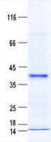 Human SPY1 / SPDYA Protein (Recombinant His, N-Terminal)