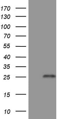 TNFRSF18 / GITR Antibody (aa26-162, clone OTI9G8)