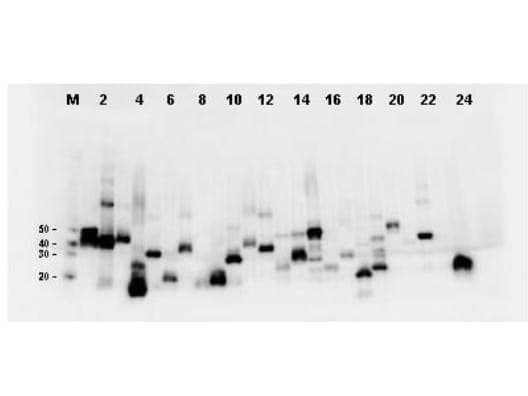DYKDDDDK Tag Antibody (clone 29E4.G7)