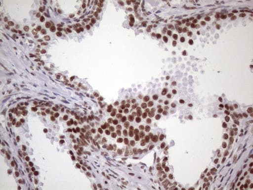 Monoclonal Mouse anti-Human NUDT21 Antibody (clone OTI1B1, Carrier-free, aa2-227, IHC, IF, WB)