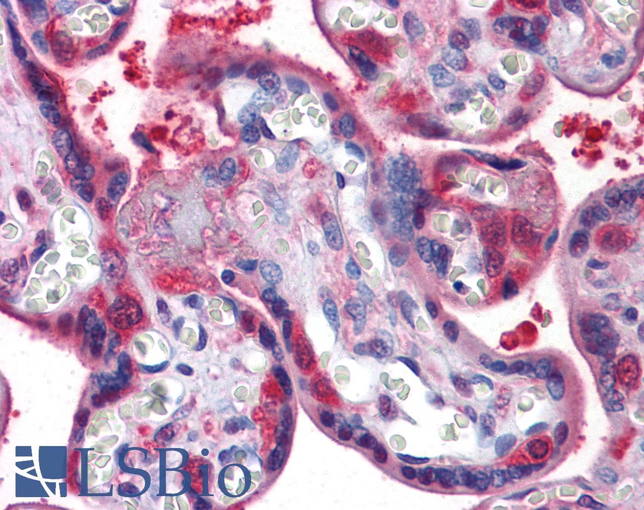 IHC-plus™ Monoclonal Mouse anti-Human LPA / Lipoprotein a Antibody (clone 8F6A9, IHC, WB)