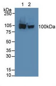 ACO1 / Aconitase Antibody (aa26-243, Biotin)