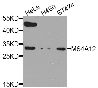 Polyclonal Rabbit anti-Human MS4A12 Antibody (WB)