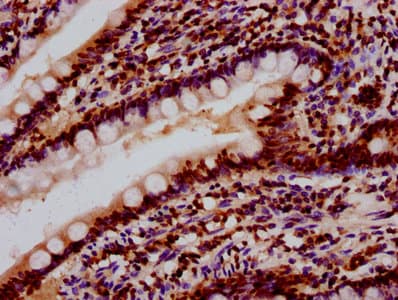 Polyclonal Rabbit anti-Human HIST1H2BN Antibody (IHC)