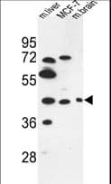 IHC-plus™ PSG3 Antibody (aa22-50)