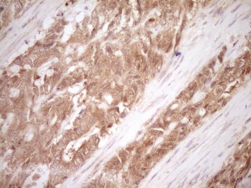 Monoclonal Mouse anti-Human CALCA Antibody (clone 2D12, IHC, WB)