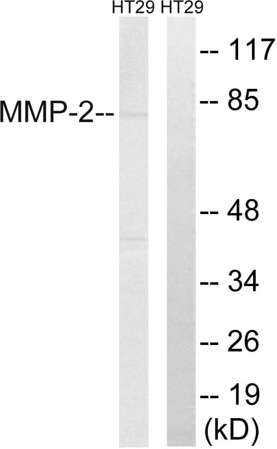 MMP2 Antibody (aa611-660)