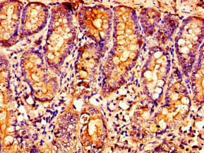 Polyclonal Rabbit anti-Human OXER1 Antibody (IHC, WB)