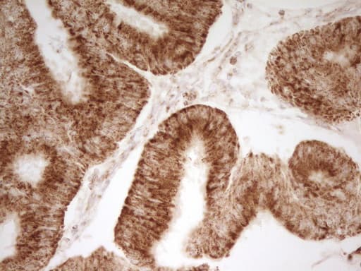 Monoclonal Mouse anti-Human MRRF Antibody (clone OTI1D5, aa56-262, IHC, WB)