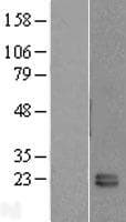 FKBP11 Protein (Over-Expression Lysate Myc-DDK (Flag))