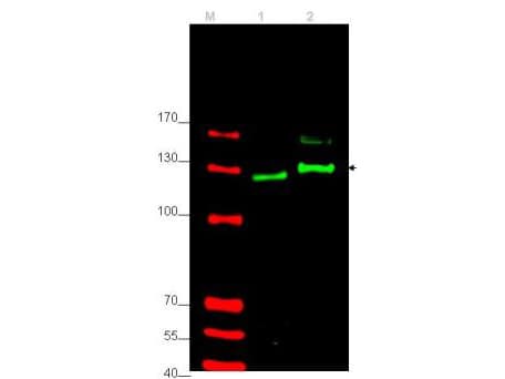 Polyclonal Rabbit anti-Human GLI2 Antibody (IHC, WB)