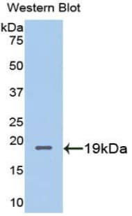 Metallothionein 2 Antibody (aa2-61)