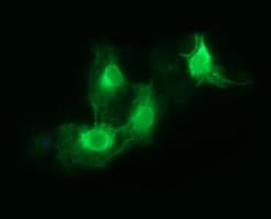 FCGR1A / CD64 Antibody (clone OTI3H9)