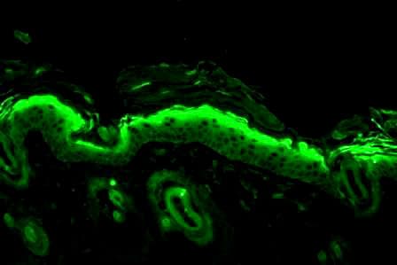 Nitrotyrosine Antibody (clone 39B6, Biotin)