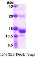 Human SNRNP25 Protein (Recombinant His)