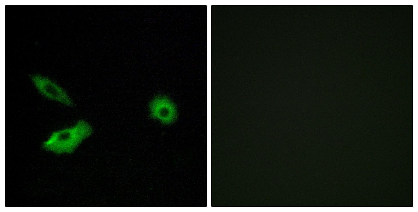OR5AR1 Antibody