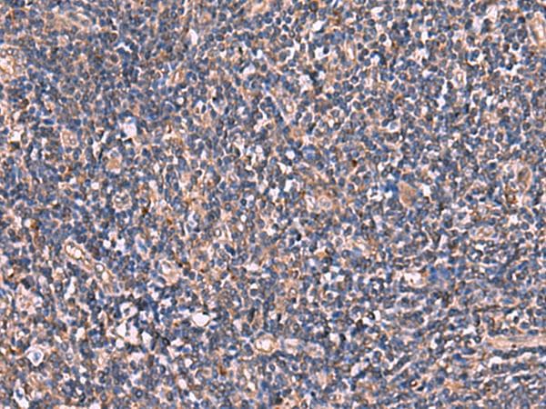 Polyclonal Rabbit anti-Human TTC38 Antibody (IHC, WB)