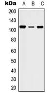 STK31 Antibody (Internal)