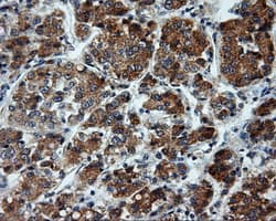 LIPG / Endothelial Lipase Antibody (clone OTI7C2)