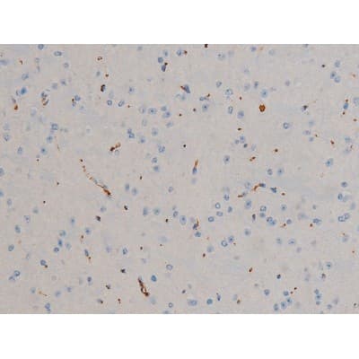 Polyclonal Rabbit anti-Human BCL2 / Bcl-2 Antibody (phospho-Ser70, IHC, IF, WB)