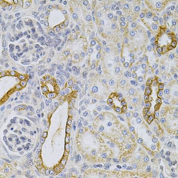 KRT20 / CK20 / Cytokeratin 20 Antibody
